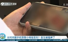 你會用小拇指托住手機嗎？醫(yī)生提醒要注意這些縮略圖